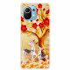 Coque Xiaomi Mi 11 Arbre Doré Coque Xiaomi Mi 11 Arbre Doré