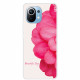 Coque Xiaomi Mi 11 Beautiful Day Coque Xiaomi Mi 11 Beautiful Day
