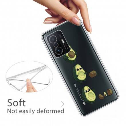 Coque Xiaomi 11T La vie d'un Avocat