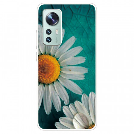 Coque Xiaomi 12 / 12X...
