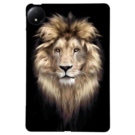 Coque Xiaomi Redmi Pad SE...
