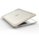 Coque MacBook Pro 13 / Touch Bar avec Supports Amovibles Coque MacBook Pro 13 / Touch Bar avec Supports Amovibles