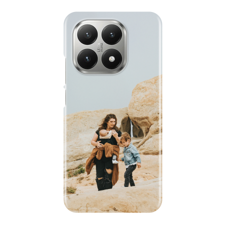 Coque personnalisée Xiaomi 15T