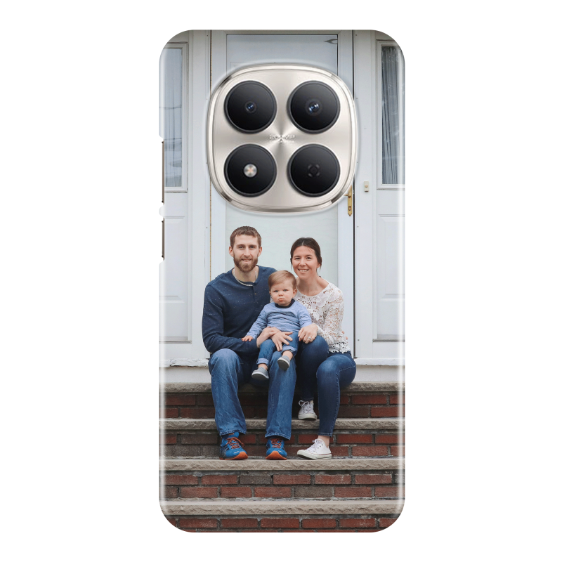 Coque personnalisée Xiaomi Redmi Note 15 Pro 5G